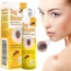 🐝 Spray eliminador de verrugas Tag Recede